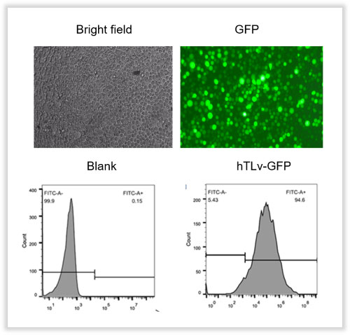 Lentivirus Infected T cells