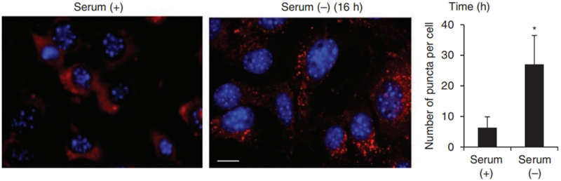 KFERQ-PAmCherry1 and PAmCherry1-KFERQ-NE virus tools